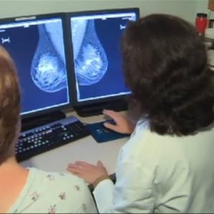 Quiet findings on breast most cancers surgical treatment